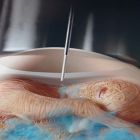 Conheça os benefícios de vacinar os embriões no incubatório